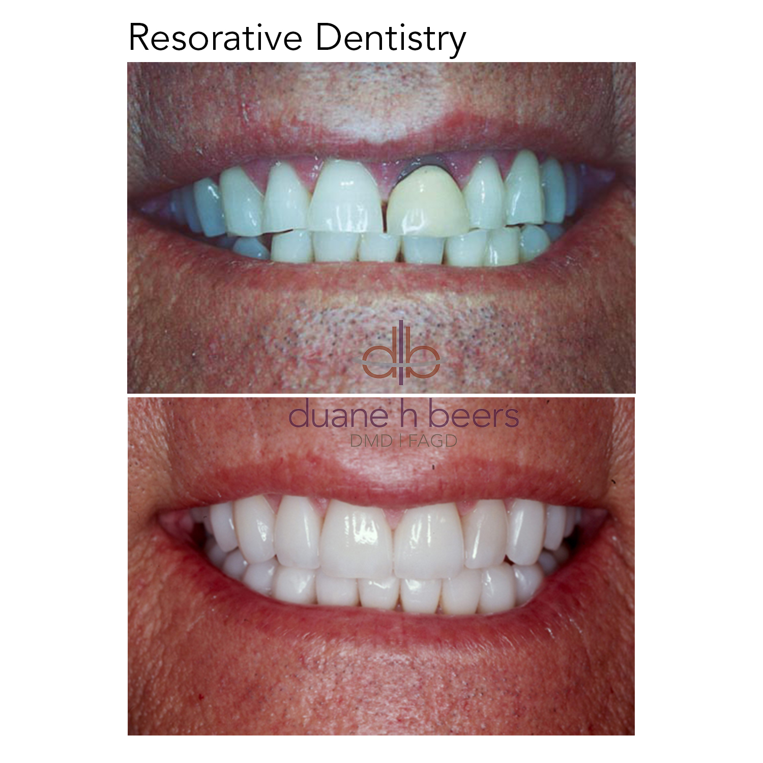 Restorative Dentistry